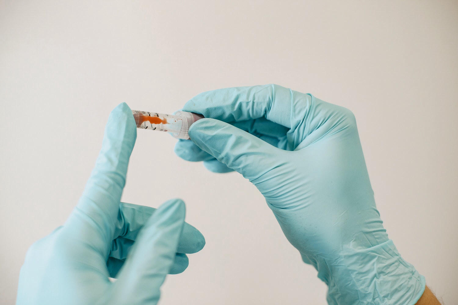 【健管師專欄】為什麼會有長新冠?有什麼症狀?會持續多久?除了腦霧、咳嗽你需要知道的長新冠補帖 - 第3張圖 【健管師專欄】為什麼會有長新冠?有什麼症狀?會持續多久?除了腦霧、咳嗽你需要知道的長新冠補帖