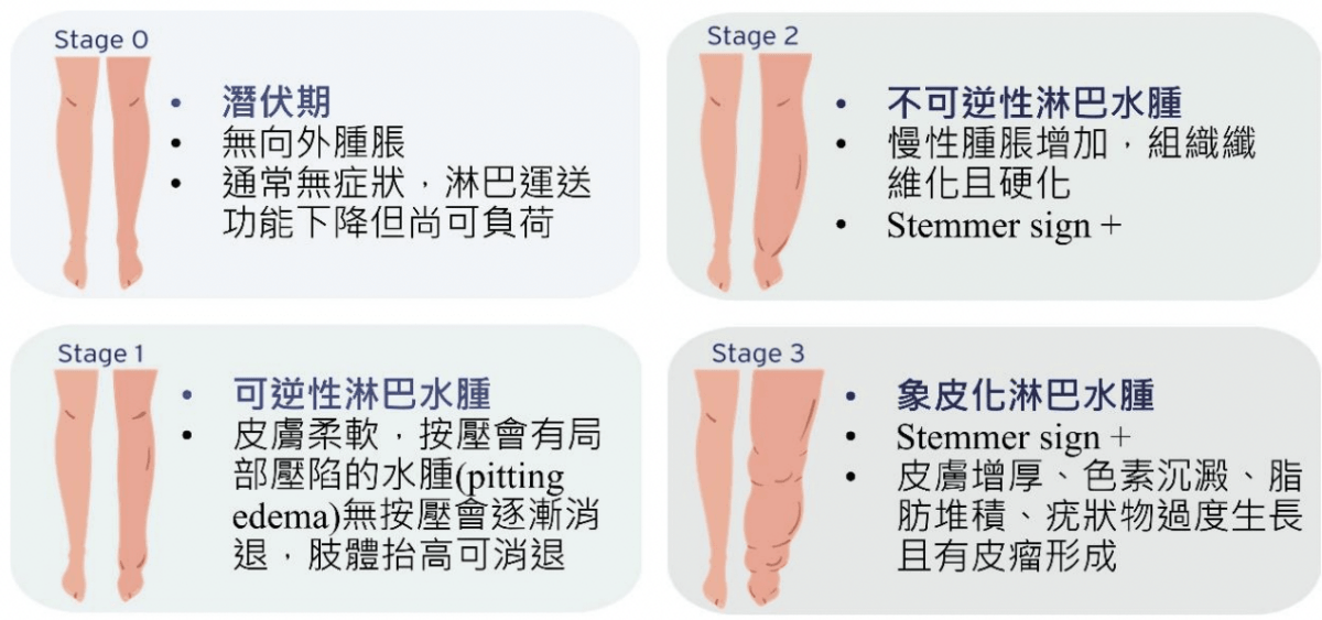 【物理治療師專欄】淋巴是什麼?腿腫起來就是淋巴問題?淋巴水腫常見5個迷思 - 第7張圖 【物理治療師專欄】淋巴是什麼?腿腫起來就是淋巴問題?淋巴水腫常見5個迷思
